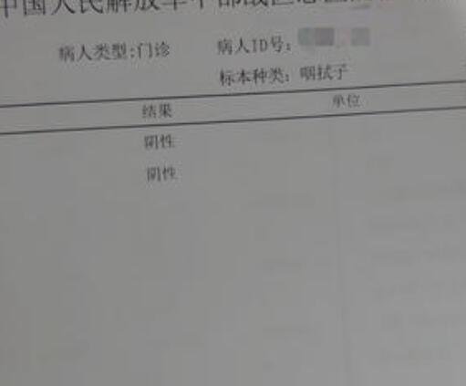 咽拭子检查多少钱哪里可以做检查呢结果多久会出来呢